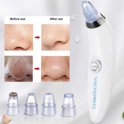 4 in 1 Rechargeable Blackhead Removal Machine – Face Acne Pore Cleaner Vacuum Suction Tool Decent Vibes