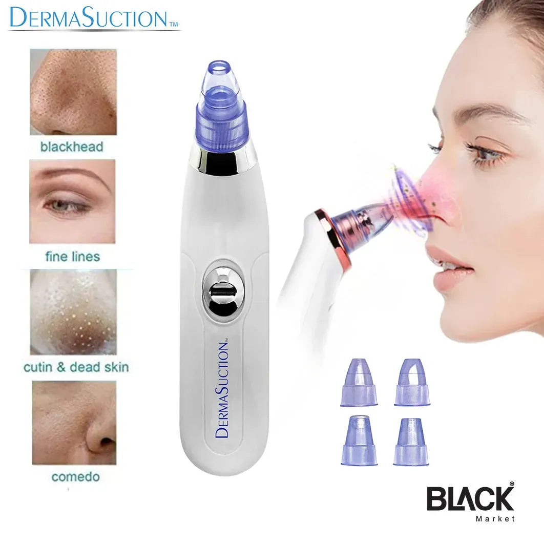 4 in 1 Rechargeable Blackhead Removal Machine – Face Acne Pore Cleaner Vacuum Suction Tool Decent Vibes