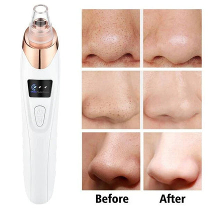 Face Vacuum Suction Blackhead Remover – Electric Deep Cleansing Pore Cleaner Decent Vibes