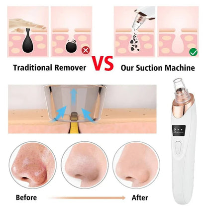Face Vacuum Suction Blackhead Remover – Electric Deep Cleansing Pore Cleaner Decent Vibes
