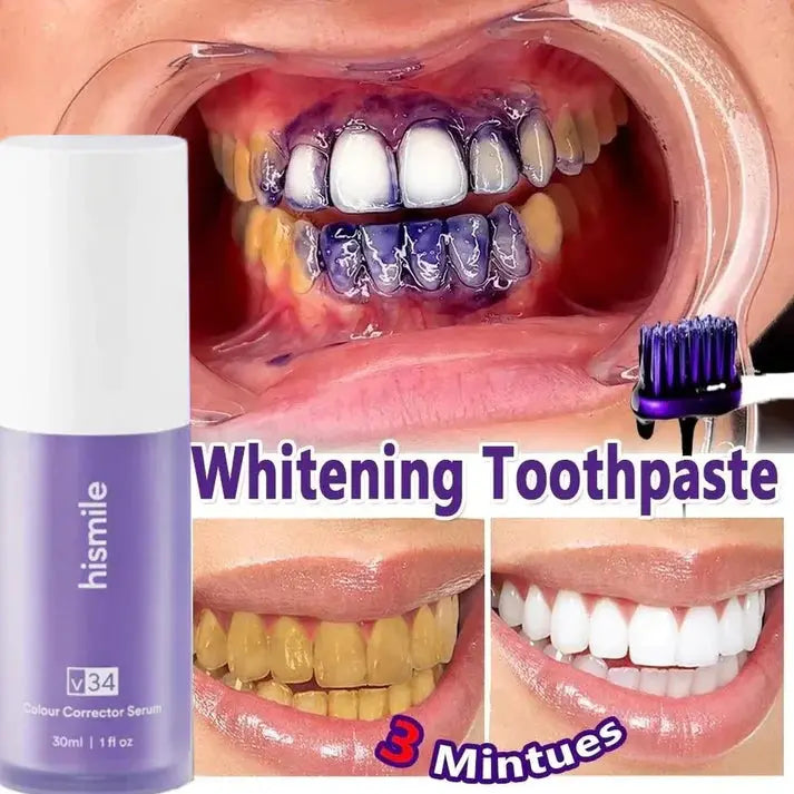 Hismile V34 Purple Teeth Whitening – Colour Corrector Serum 30 ml Decent Vibes