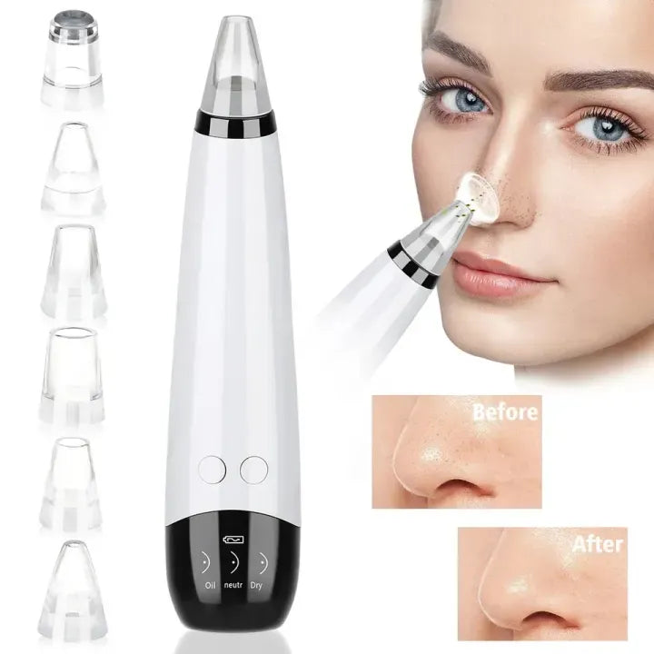 Vacuum Blackhead Remover Cleaner – Professional Pore Extractor with 3 Modes Decent Vibes