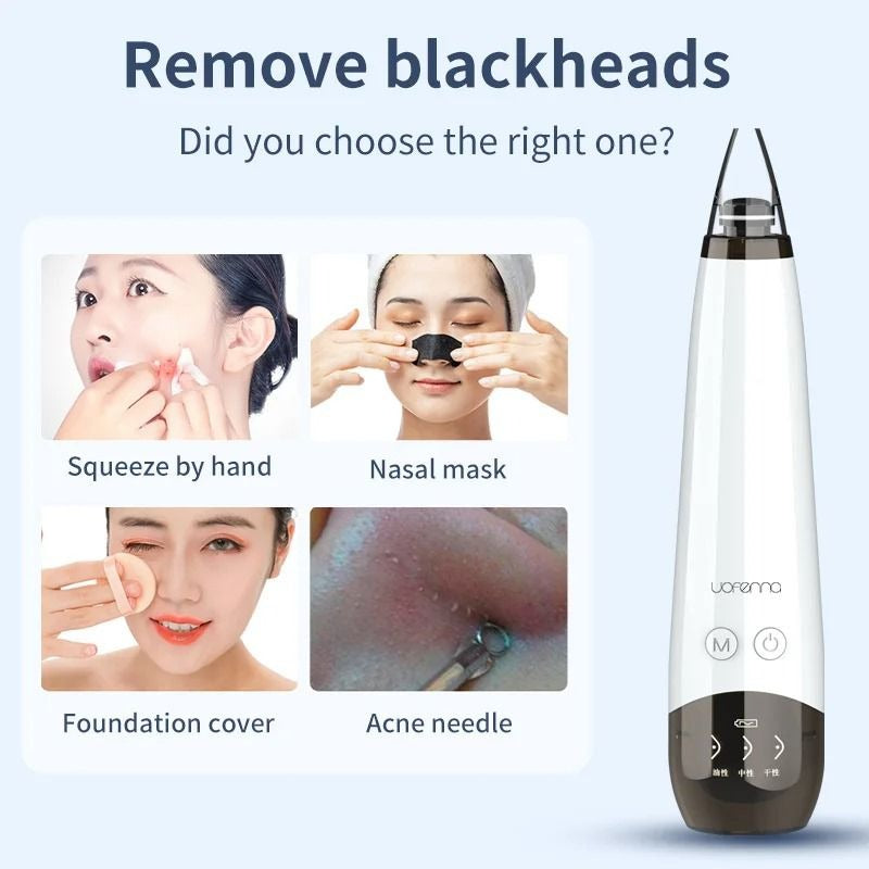 Vacuum Blackhead Remover Cleaner – Professional Pore Extractor with 3 Modes Decent Vibes